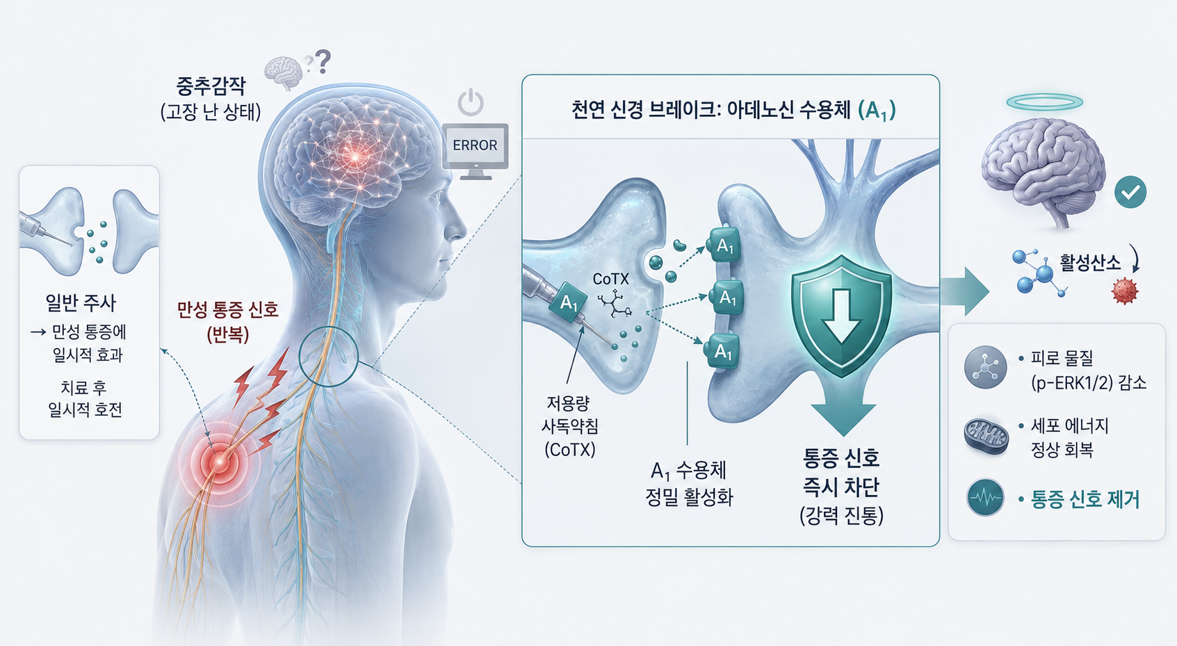 반복적인 사독약침 만성통증 신호로 인해 고장 난 중추감작 상태의 뇌와 척수 신경계를 저용량 사독약침(CoTX)이 아데노신 A1 수용체를 정밀 활성화하여 통증 신호를 차단하고 피로 물질을 제거하는 메커니즘을 설명하는 인포그래픽 이미지.